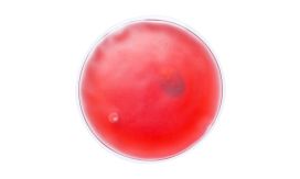 Relief, compresă cald, roșu